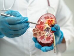 5 Kebiasaan Harian yang Sering Diabaikan dan Picu Kanker Ginjal