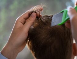 Kenali Tanda-Tanda Kutu Rambut dan Cari Solusi Efektif untuk Menghilangkannya dengan Cepat dan Aman