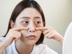 Cara Menghilangkan dan Mencegah Eye Bags dengan Efektif