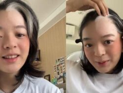 5 Fakta Wanita Terkena Vitiligo Setelah Bleaching Rambut