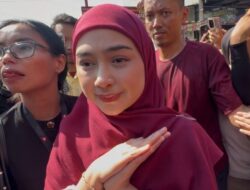 Ria Ricis Akhirnya Buka Suara Soal Oplas Hidung, Alami Kondisi Ini Selama 5 Tahun Hingga Butuh Tulang Iga