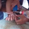 Jari Membengkak Terjepit Ring Besi, Bocah 9 Tahun Datang ke Damkar Brebes Minta Bantuan
