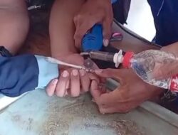 Jari Membengkak Terjepit Ring Besi, Bocah 9 Tahun Datang ke Damkar Brebes Minta Bantuan